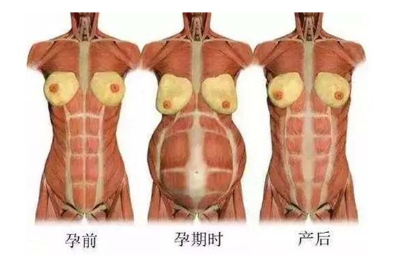 產(chǎn)后媽媽骨盆修復――帶你回到完美身材！