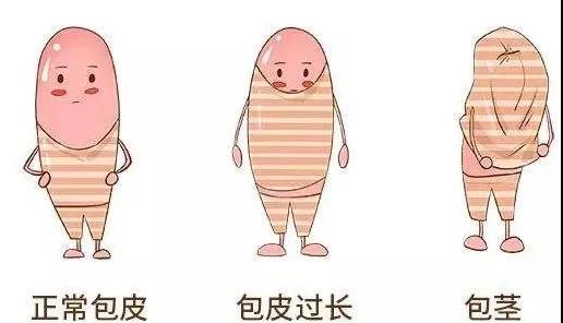 【保山安利醫(yī)院】家長速看！暑期包皮手術(shù)預約正當時！