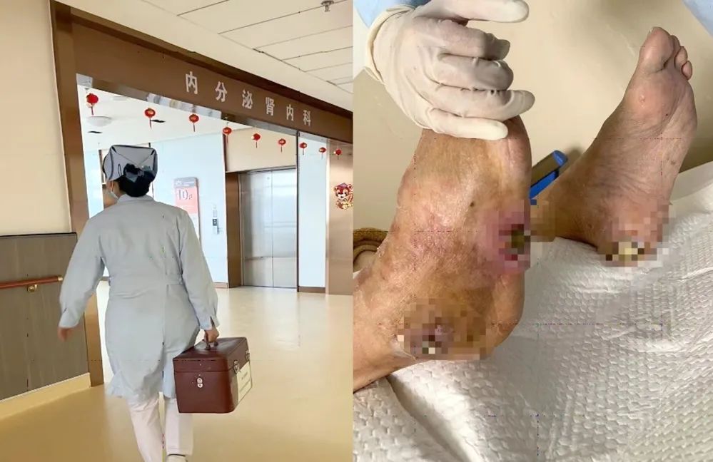 【保山安利醫(yī)院】傷口治療一站式，健康生活零距離！